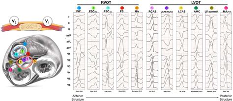 rvot free wall pvc